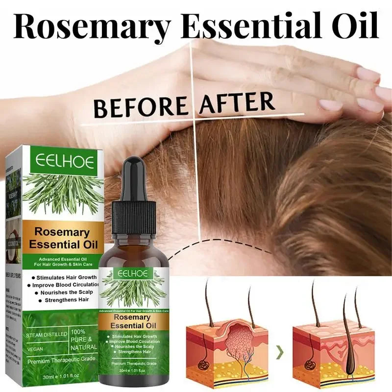Rosemary Essentiall Oil Hair Growth Products Organic  Products Scalp Hair Strengthening Oil For Nourish Shiny  Healthy